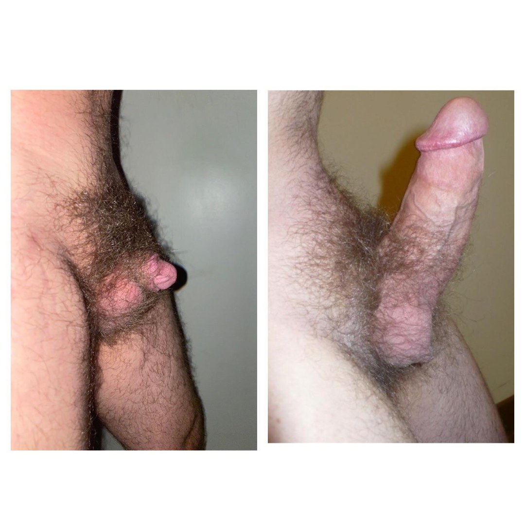 Erección de miembro peludo