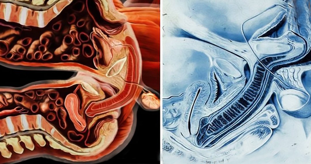 Vagina desde el interior en la sección