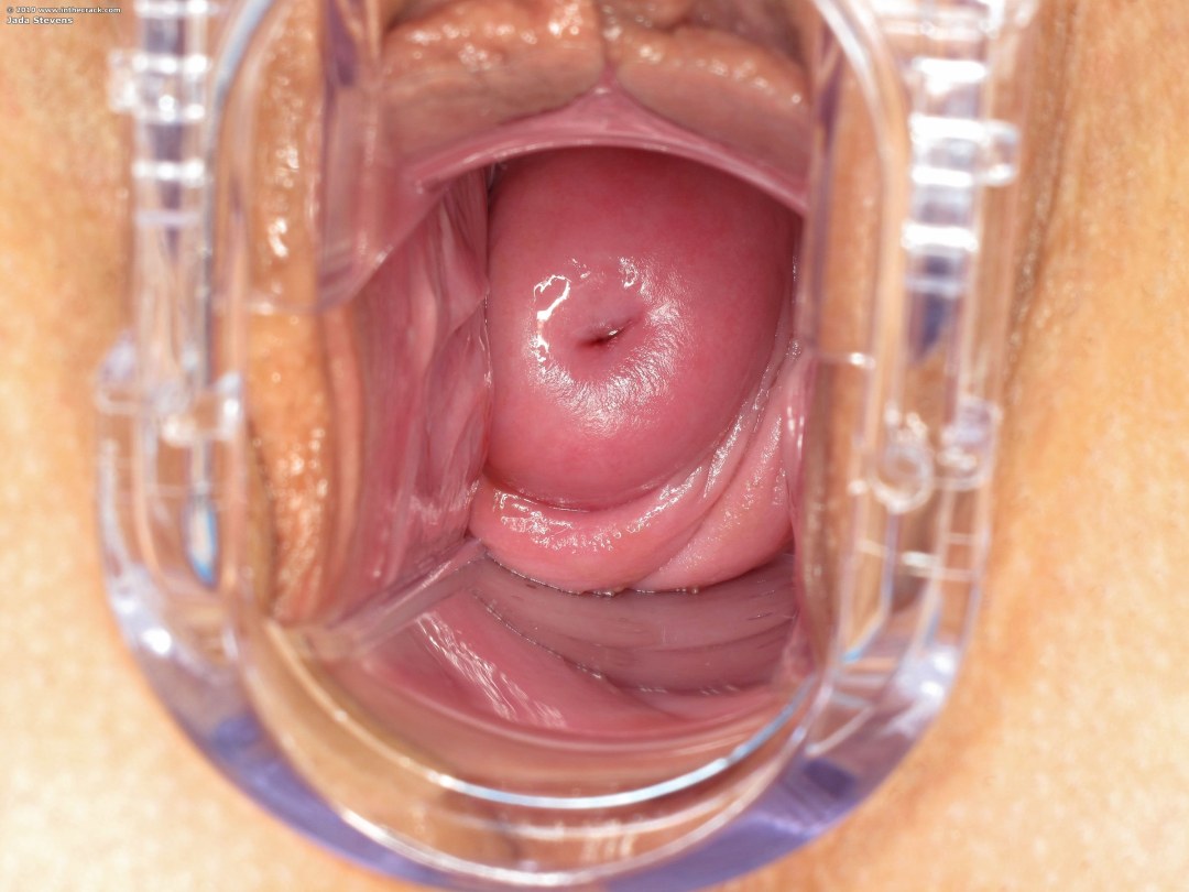 Vagina sana desde el interior