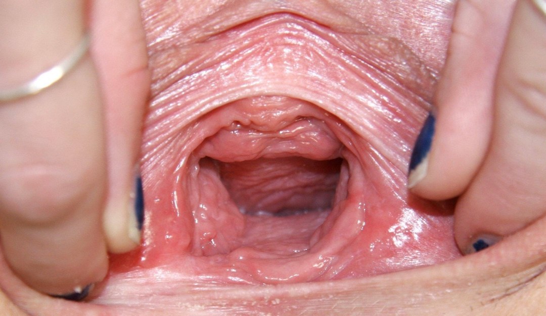 Vagina de mujeres en el interior