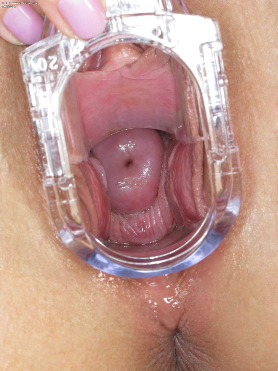 La cámara dentro de la vagina
