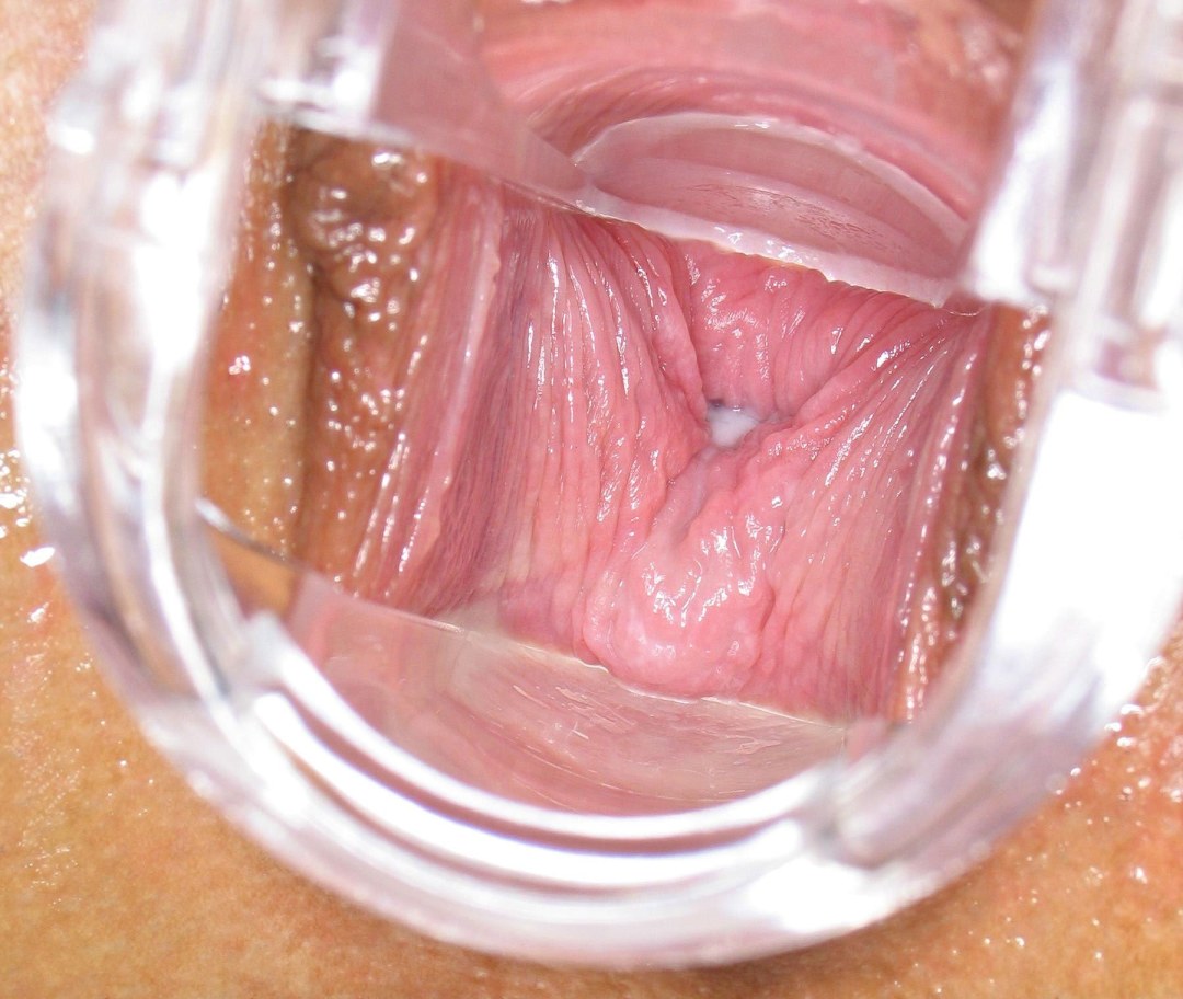 La cámara dentro de la vagina