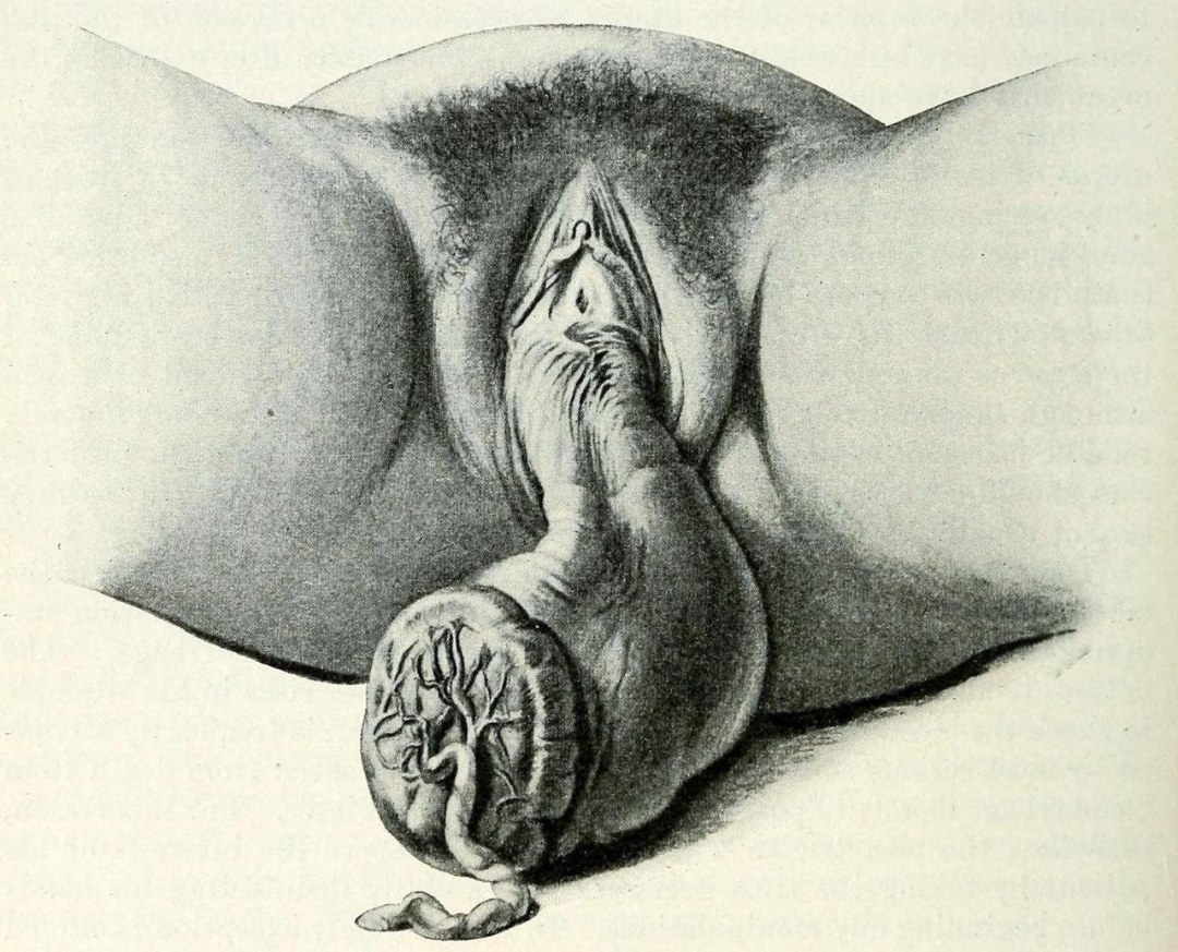 Anatomía de la entrepierna de mujeres