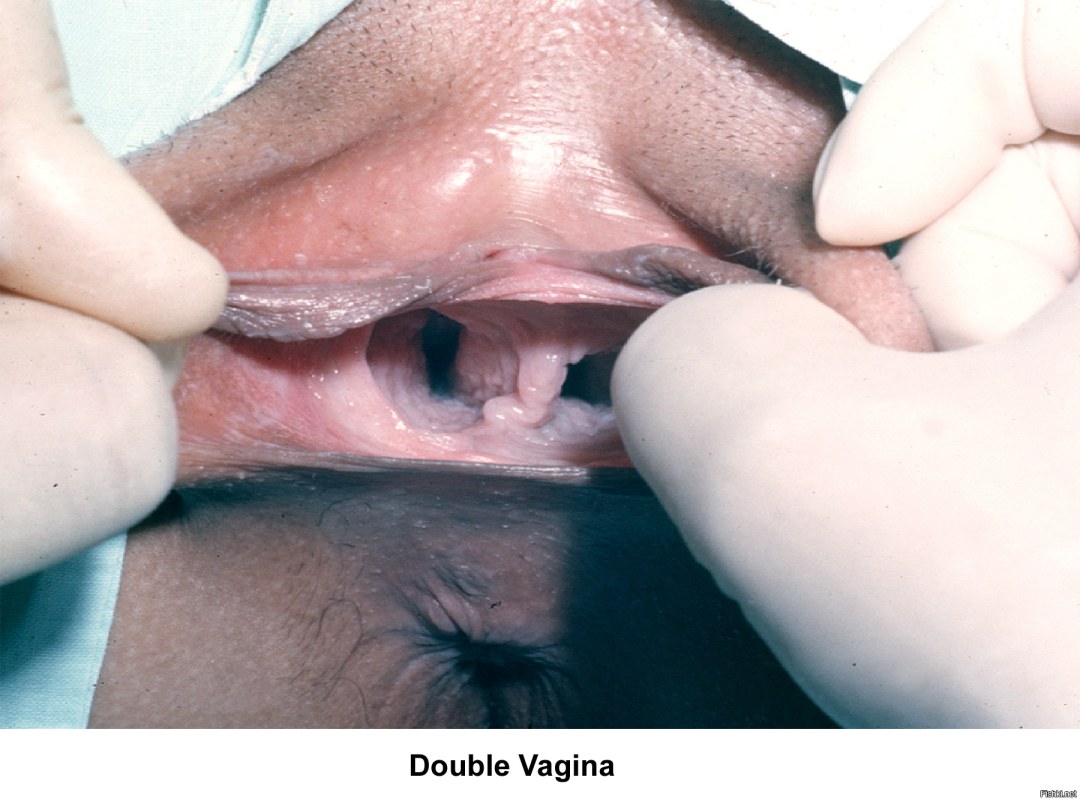 Hazel Jones (vagina Hazel Jones