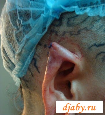 Девушка с самыми большими губами