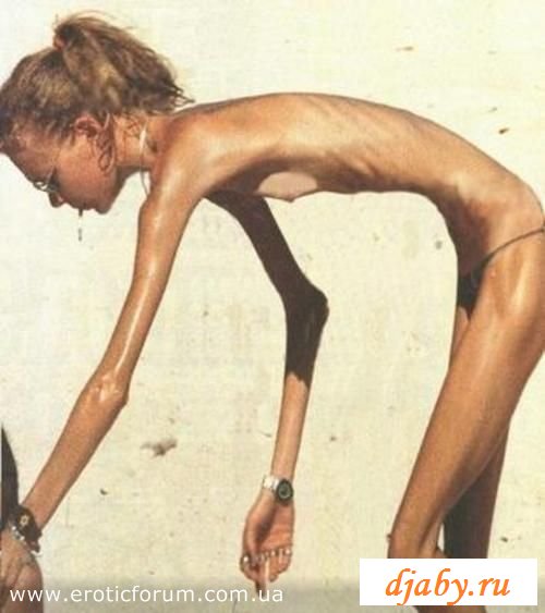 Худые тела голых анорексичек