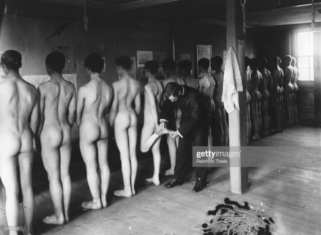 Медосмотр голых женщин ретро