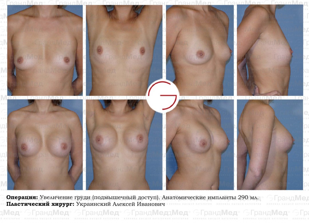 Много голых баб на кастинге