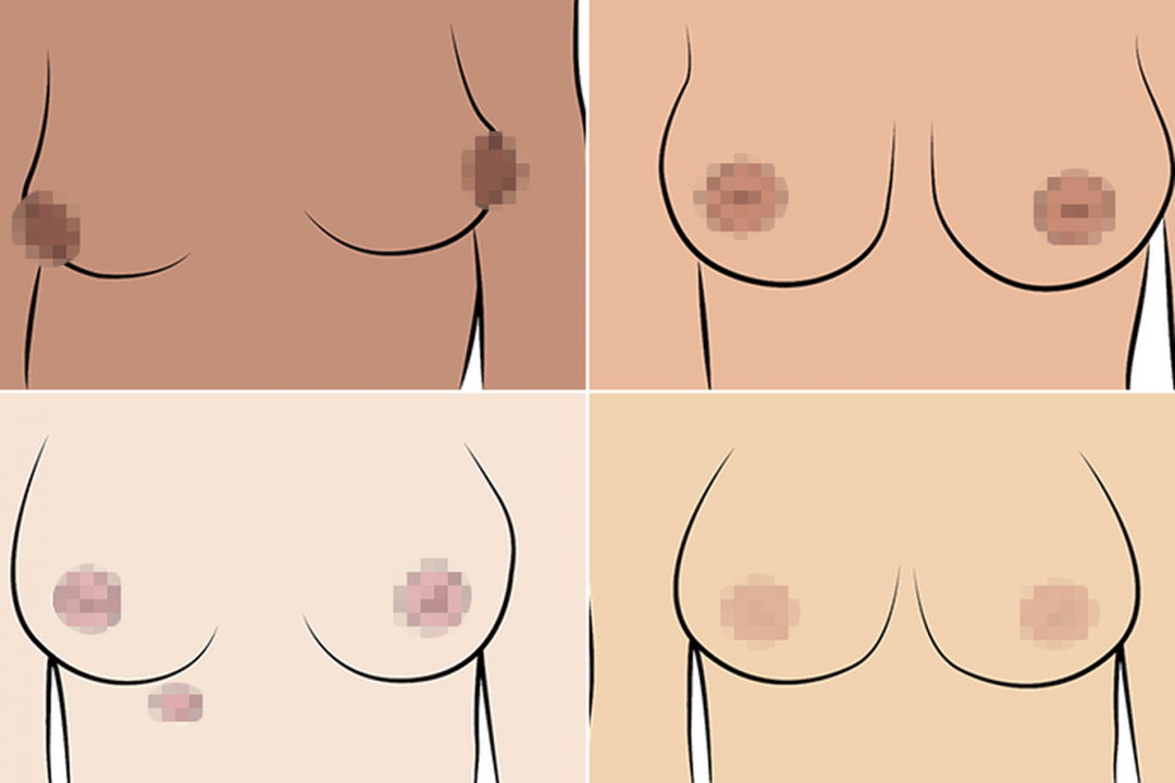 Женские сиськи разных размеров