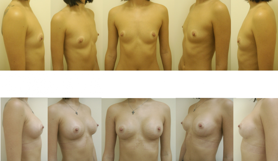 Размеры женской груди ню