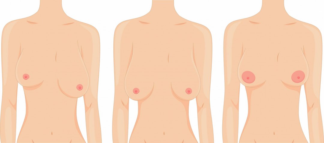 Накладная силиконовая грудь