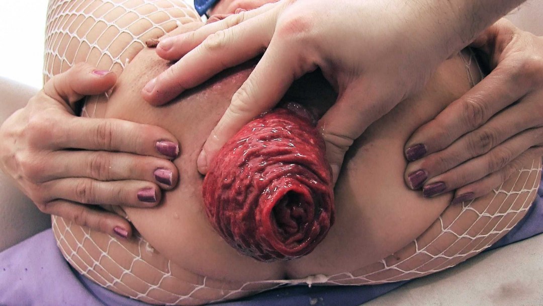 Огромная вывернутая вагина