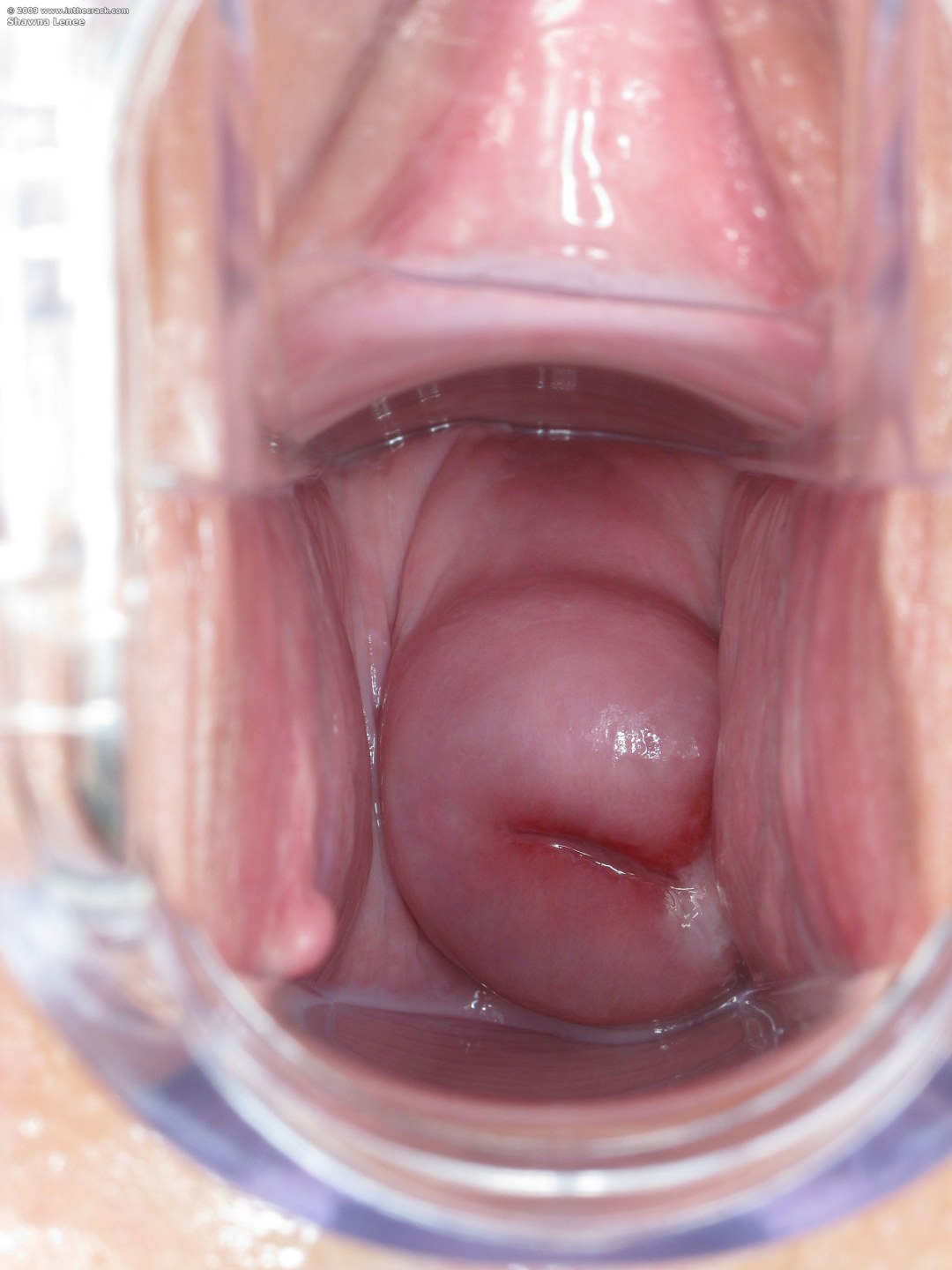 Раскрытая вагина крупным планом