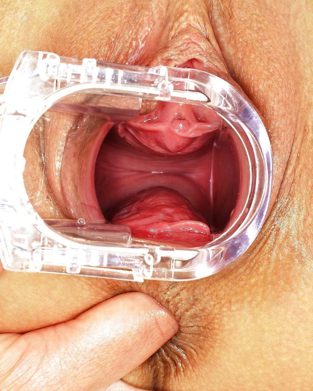 Влагалище и матка изнутри