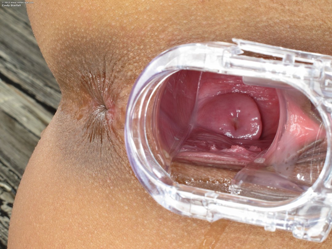 Женское влагалище изнутри