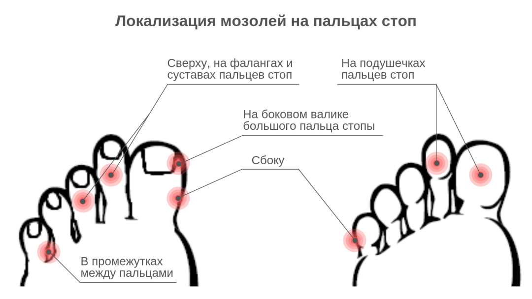 Фанера дратути