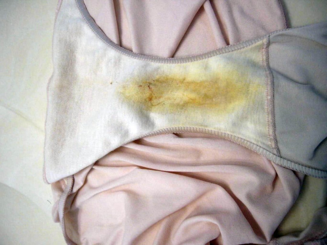 Толстые волосатые в трусах