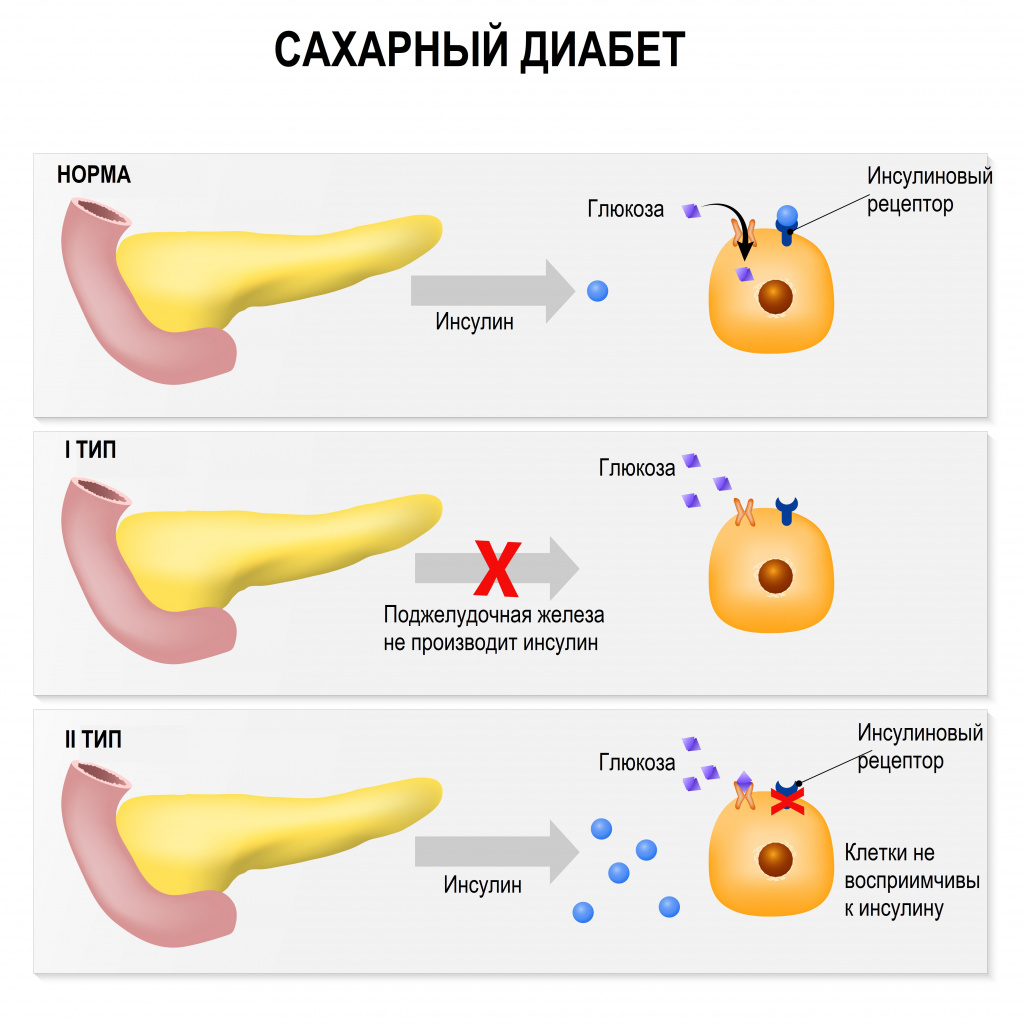 Бонни Роттен школьница