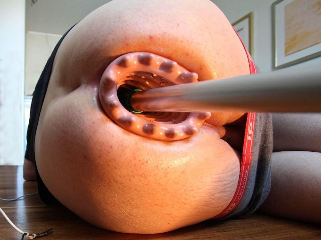 Необычное анальное отверстие