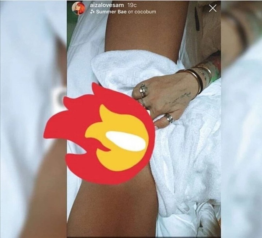 Айза Анохина случайно