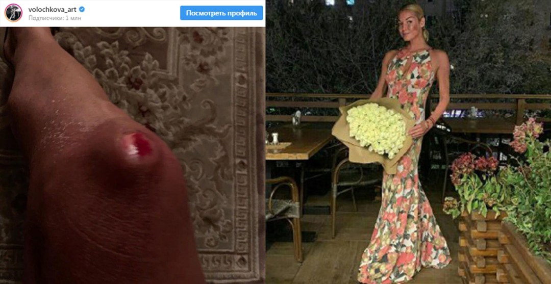 Анастасия Волочкова голая